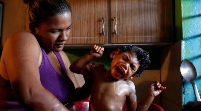 Venezuela News | People with Disabilities